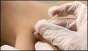 dry needling